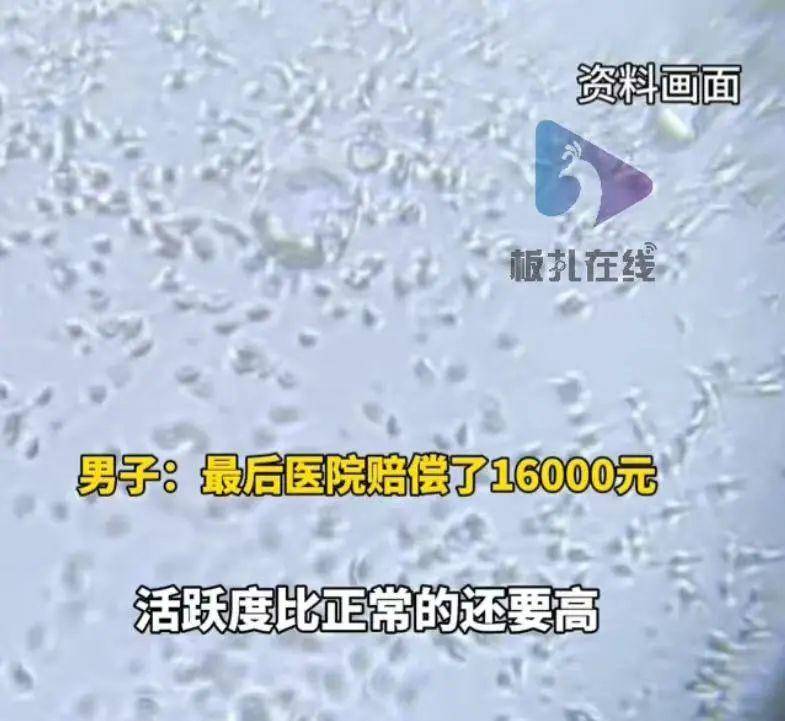 男子结扎3个月后老婆又怀孕 检测后显示精子活跃度比正常人还高