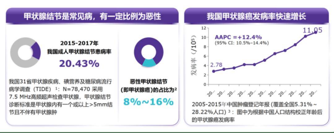 中山医院内分泌科“内分泌代谢临床与实践大讲堂”｜第二期：甲状腺结节的评估-蒋晶晶教授